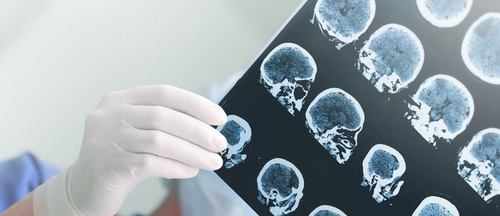 A healthcare provider holding up an x-ray image of multiple brain scans.