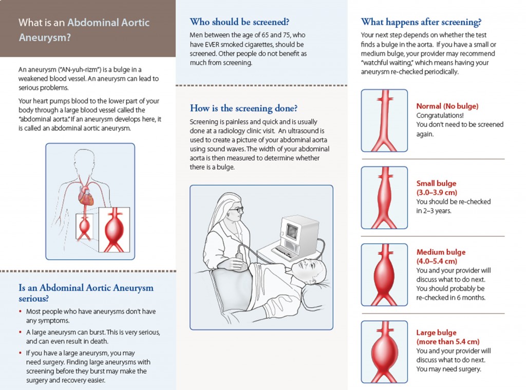 A diagram of an abdominal aortic aneurysm, how screening is done and what happens after screening.