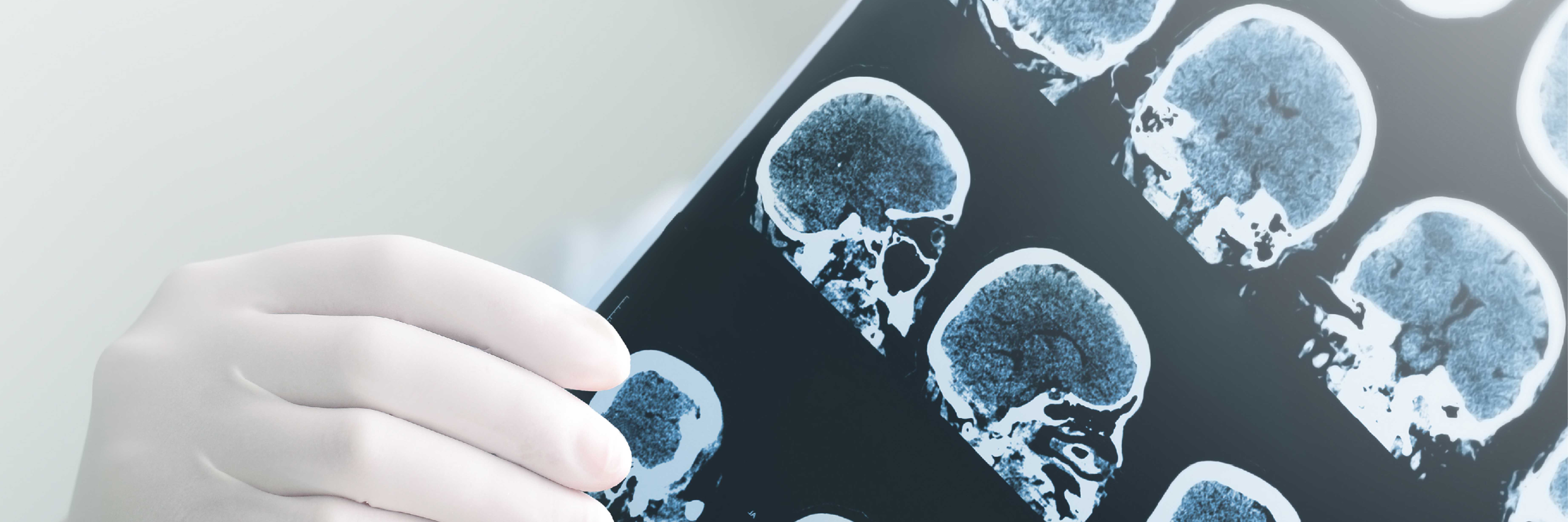 HA healthcare provider holding up an x-ray image of multiple brain scans.